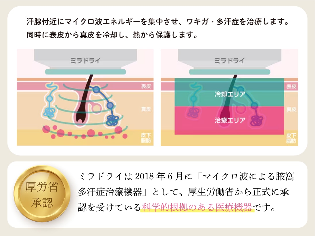 ミラドライ